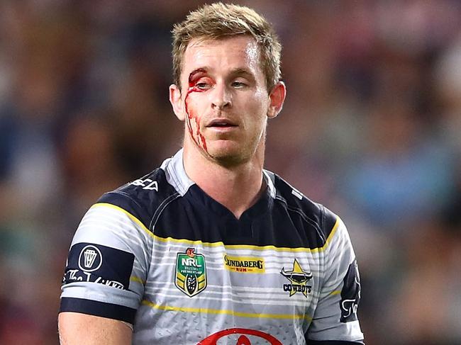 SYDNEY, AUSTRALIA - SEPTEMBER 23: Michael Morgan of the Cowboys bleeds from a cut above his eye during the NRL Preliminary Final match between the Sydney Roosters and the North Queensland Cowboys at Allianz Stadium on September 23, 2017 in Sydney, Australia.  (Photo by Mark Kolbe/Getty Images)