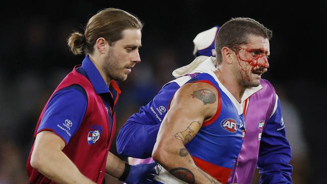 MELBOURNE , AUSTRALIA. May 4, 2024.  AFL Round 8. . Western Bulldogs vs Hawthorn at Marvel Stadium.   Bulldog Tom Liberatore heads to the bench after copping an accidental boot in the heads in the dying minutes   . Pic: Michael Klein