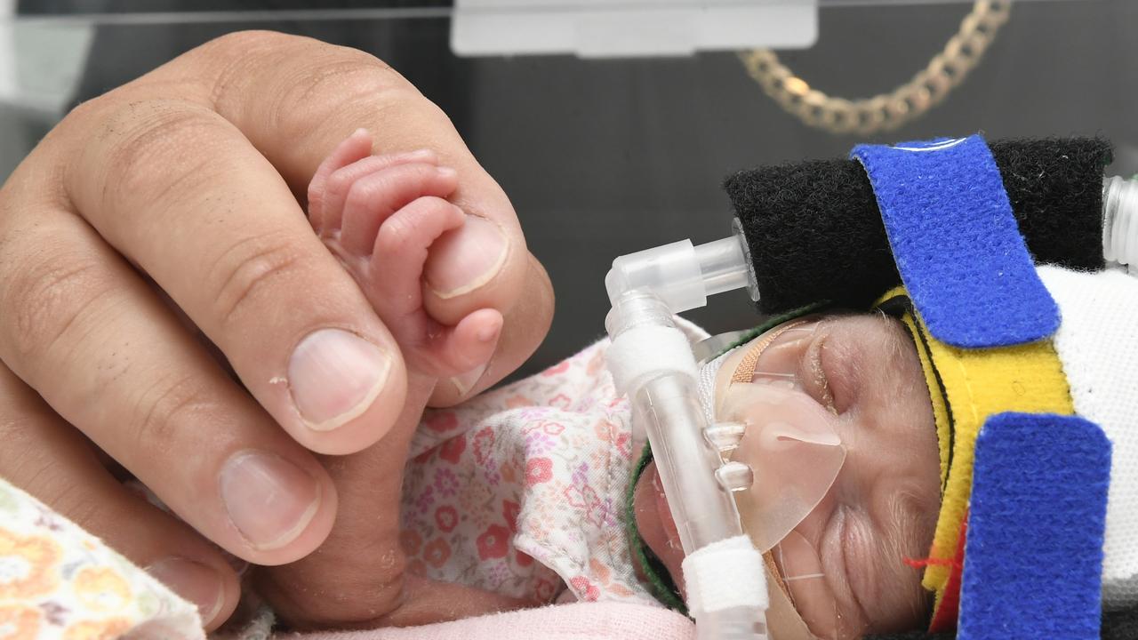 Tiny bub Yohana is currently undergoing care in the Townsville Hospital's NICE ward.