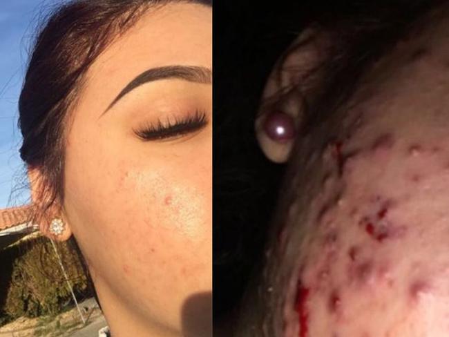 Pictures on Twitter show her skin before and after the treatment.