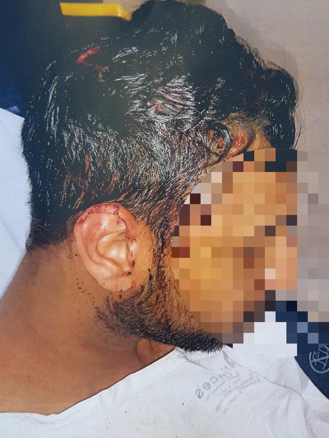 A 25-year-old man was attacked with a taser. Picture: Supplied