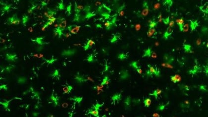 A COVID-19 infected mouse brain from the study showing ‘angry’ microglia in green and SARS-CoV-2 in red. Picture: Supplied