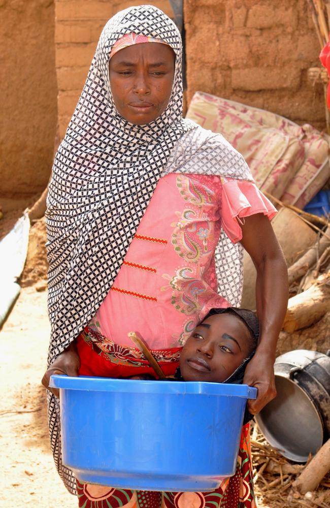 Rahma Haruna was born without limbs and lives in a bowl | Video