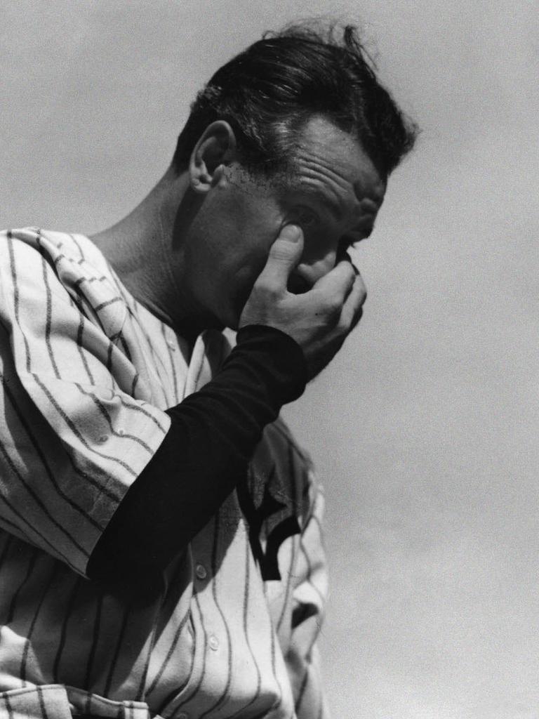 Baseball great Lou Gehrig died of ALS, which is sometimes called Lou Gehrig’s disease.