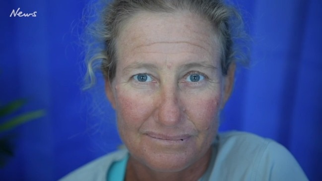 Commercial fisho Juanita Davey tells of how she almost lost her hand in battle with shark