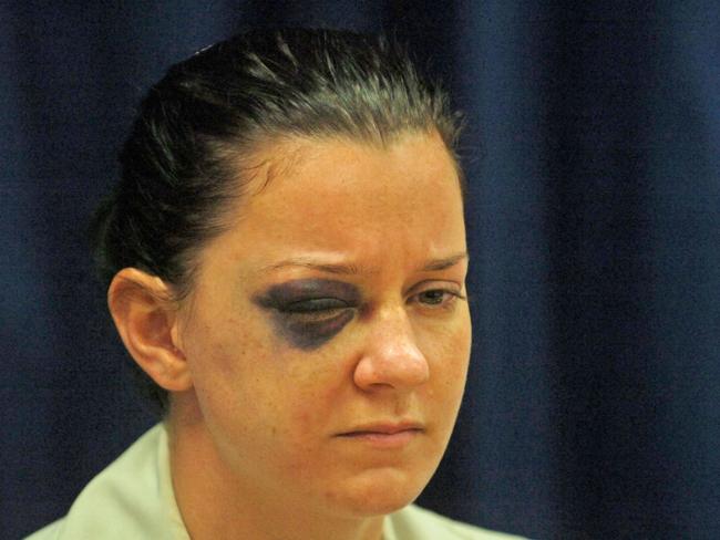 Constable Tenelle Luscombe at Mundingburra Police Station. She was injured when she was king-hit in a brawl in Flinders St East.