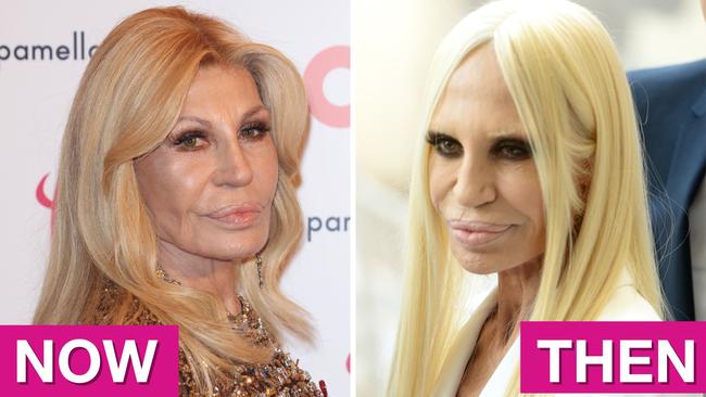 Donatella Versace's new face pics. Picture: Getty Images