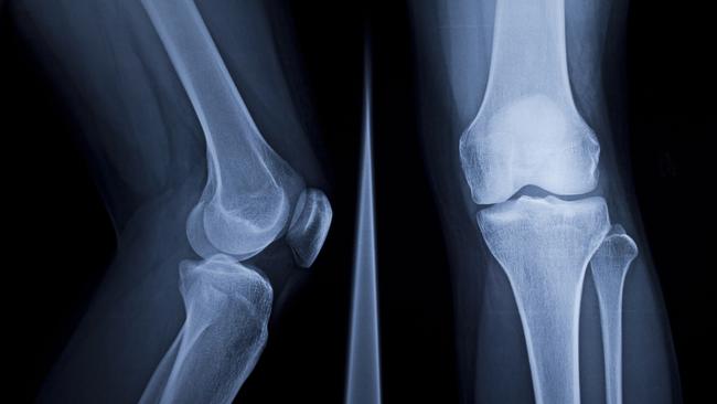 Healius has been running an auction for its diagnostic imaging business through investment bank UBS. Picture: iStock.