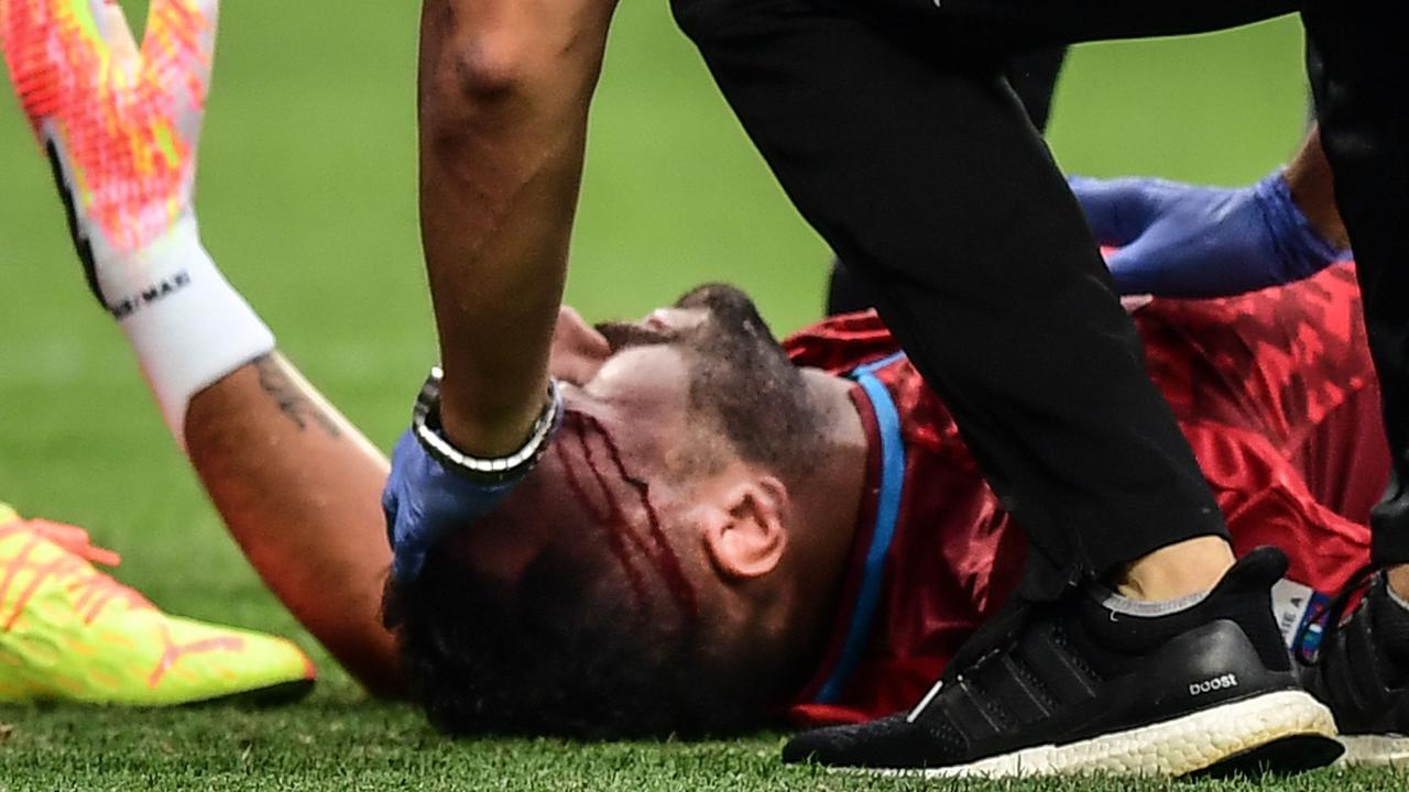 David Ospina was left covered in blood and needing a stretcher after a horror head injury on Thursday night.