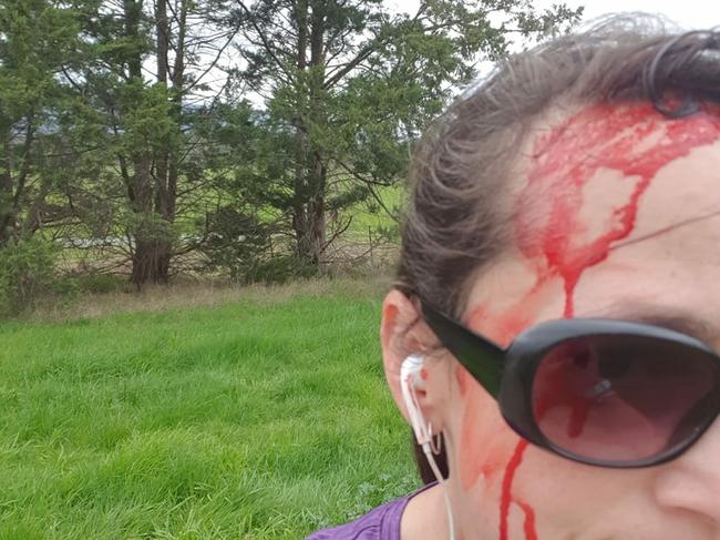 Therese was dive-bombed by a magpie on the Warburton Trail.