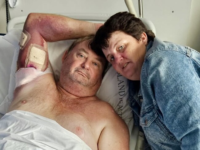 Brett and Jennifene Grant pictured in Townsville University Hospital on Wednesday afternoon four days after the Ingham man was savaged by two pig dogs at the Showgrounds on Saturday. Mr Grant said he sustained a total of 13 serious bites, with nine below and including the knee, one on the upper left thigh, one on the stomach and two to the right bicep as he protected his throat. Picture: Supplied