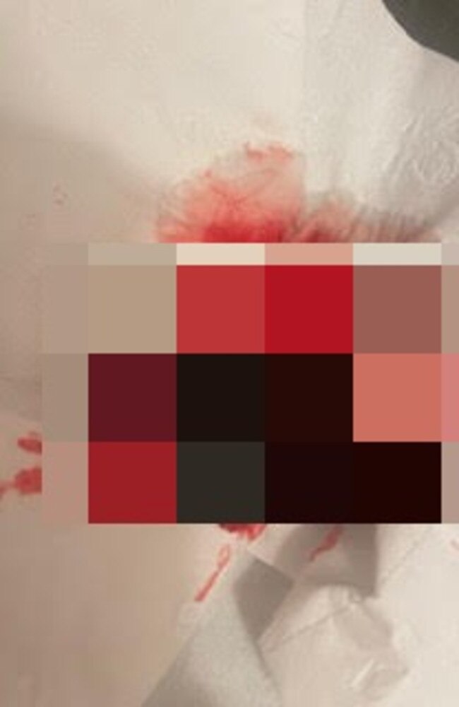 On May 14 Ms Southwell said she woke to heavy bleeding as well as a blood clot "bigger than a 50c coin". Picture: Supplied/Nikkole Southwell. Taken at Ms Southwell's home.