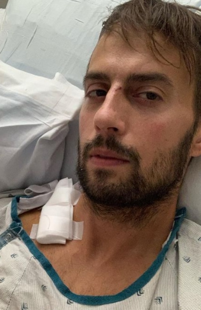 Lady Gaga's dog walker Ryan Fischer in hospital. Picture: Instagram