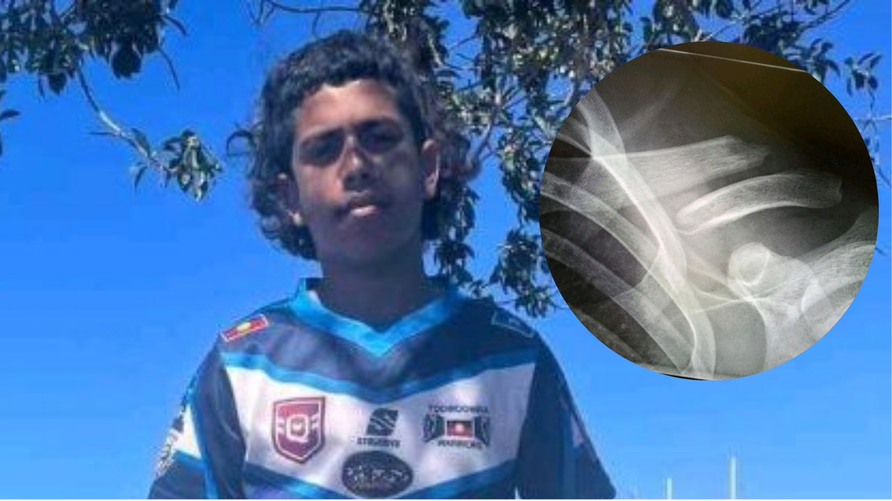 Blake Cubby-Francisco had his collarbone broken in an assault at a Junior Rugby League Carnival.