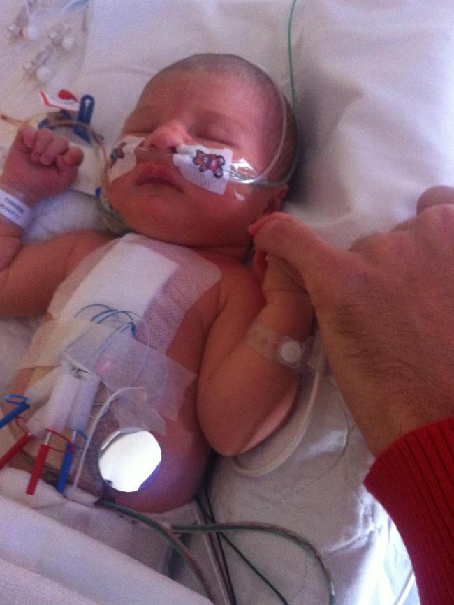 Adelaide baby Kit Bate was rushed to Melbourne for life-saving surgery soon after she was born.