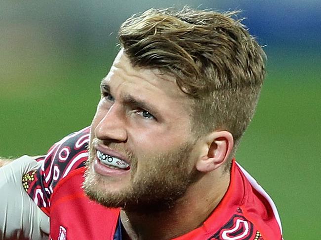 MELBOURNE, AUSTRALIA - JUNE 27: Dom Shipperley of the Reds is seen to by medical staff during the round 17 Super Rugby match between the Rebels and the Reds at AAMI Park on June 27, 2014 in Melbourne, Australia. (Photo by Robert Prezioso/Getty Images)