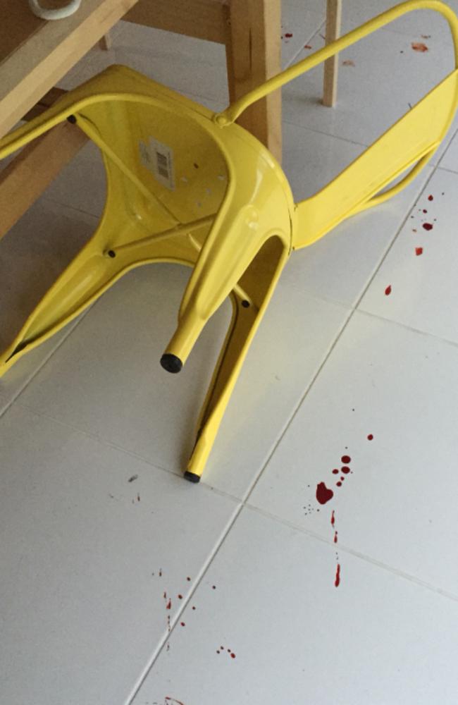 The aftermath ... the chair that chopped off Mark Bulman’s toe. Picture: Supplied