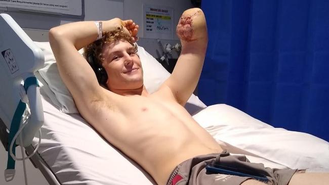 British backpacker Henry Dunn lost his lower left arm after a workplace accident on a remote Northern Territory cattle station.