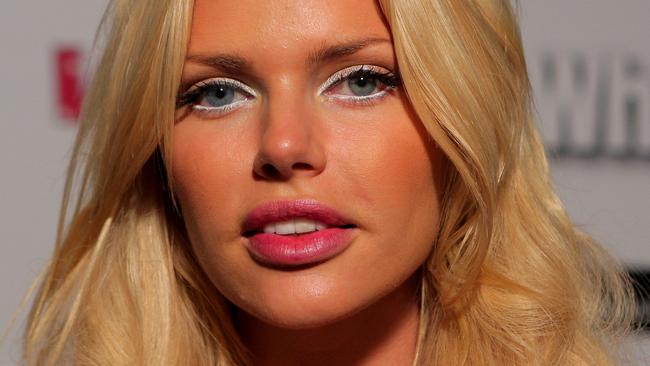 Sophie Monk wishes she didn’t get lip fillers.