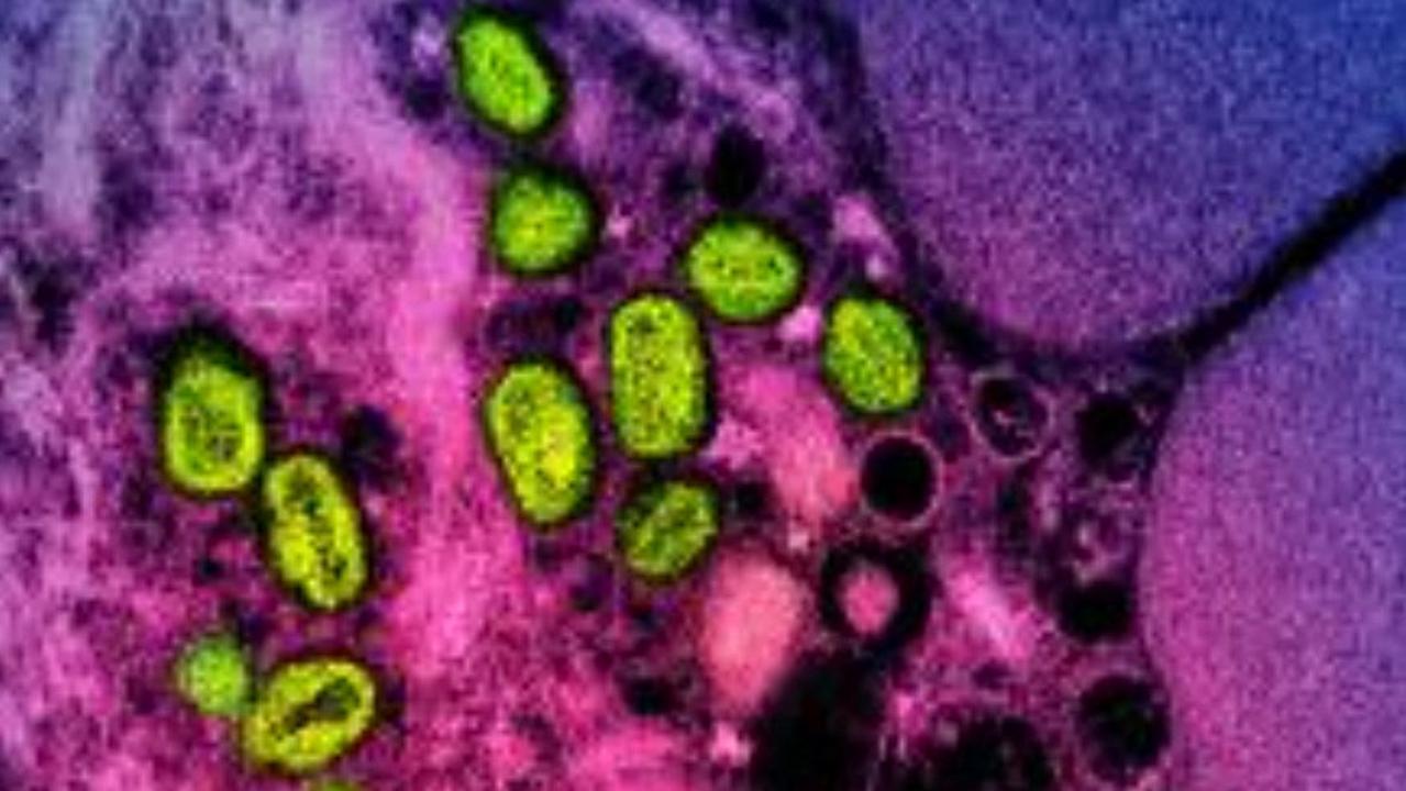 Mpox particles (green) found within an infected cell, Picture: National Institute of Allergy and Infectious Diseases/AFP