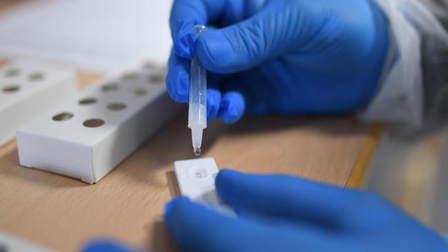 A sample being processed from a rapid antigen test for Covid-19. Picture: AFP