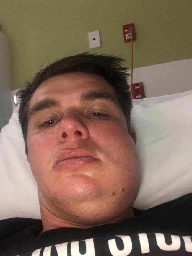 Trinity Old Scholars player Carl Teusner wound up in hospital with a broken jaw.