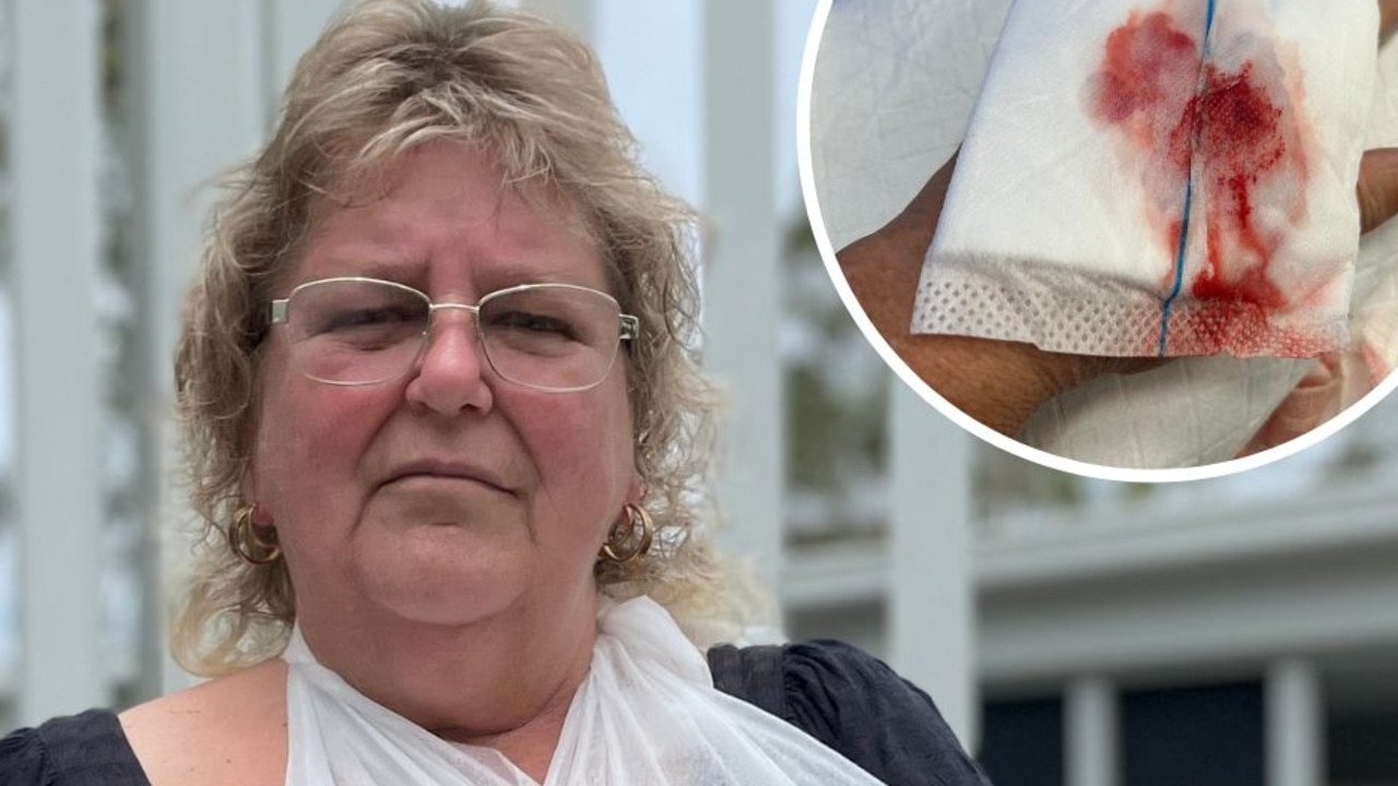 ‘They could have killed you’: Mum opens up on terrifying dog attack