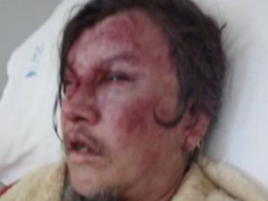 A man has received horrific injuries after being bashed. Picture: 9 News