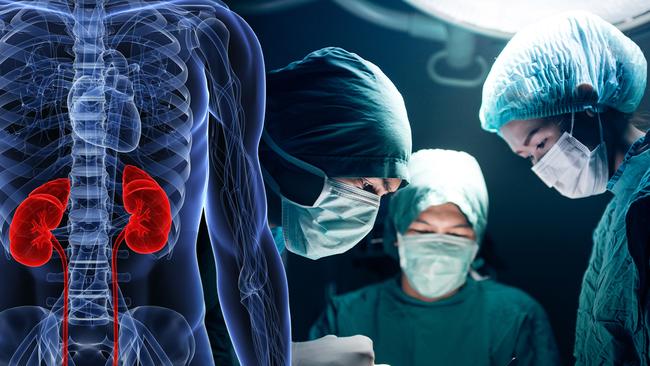 Surgeons are using more organs after people die from circulatory death, allowing them to transplant more kidneys.