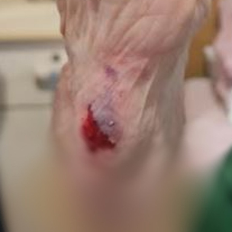 One aged care resident suffered injuries after falling getting on a bus without help. Picture: Supplied