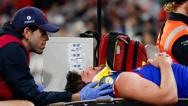 Angus Brayshaw of the Demons was forced in to medical retirement. (Photo by Dylan Burns/AFL Photos via Getty Images)