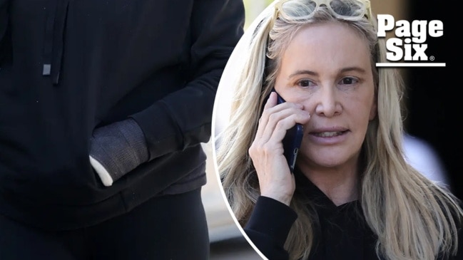 Shannon Beador Spotted With Arm Cast, Facial Bruising After Entering ...