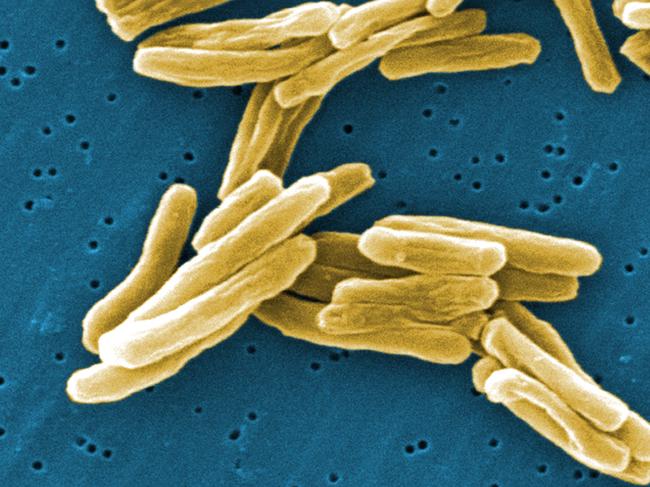 The Mycobacterium tuberculosis bacteria.