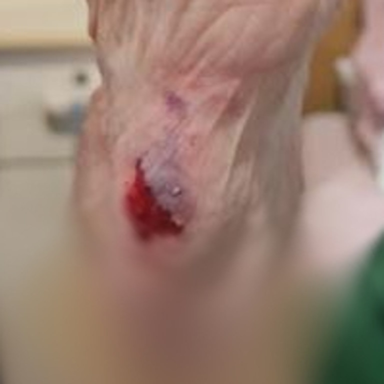 One aged care resident suffered injuries after falling getting on a bus without help. Picture: Supplied