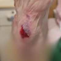 One aged care resident suffered injuries after falling getting on a bus without help. Picture: Supplied