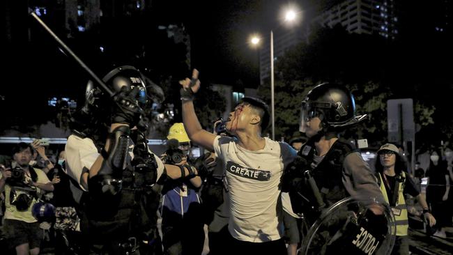 A bleeding man reacts as he is taken away by policemen after attacked by protesters outside Kwai Chung police station in Hong Kong, Wednesday, July 31, 2019. Protesters clashed with police again in Hong Kong on Tuesday night after reports that some of their detained colleagues would be charged with the relatively serious charge of rioting. (AP Photo/Vincent Yu)