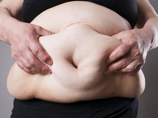 Being overweight might not be completely your fault, research suggests. Picture: istock