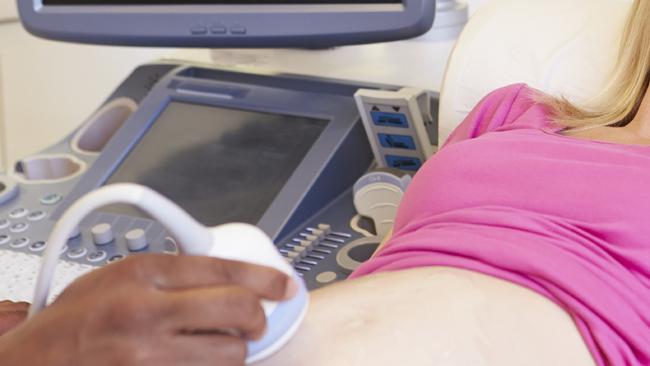 Generic photo illustrating IVF. Pregnant Woman And Partner Having 4D Ultrasound Scan. Picture: iStock