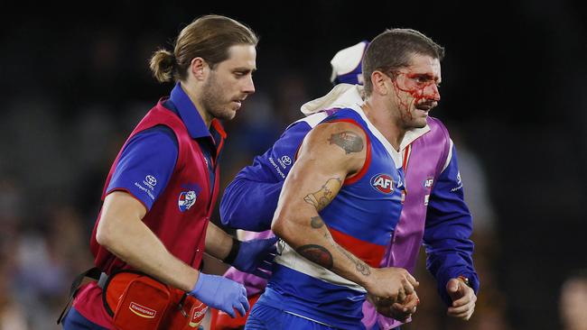 MELBOURNE , AUSTRALIA. May 4, 2024.  AFL Round 8. . Western Bulldogs vs Hawthorn at Marvel Stadium.   Bulldog Tom Liberatore heads to the bench after copping an accidental boot in the heads in the dying minutes   . Pic: Michael Klein