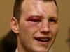 Cleanskin who gave it his all