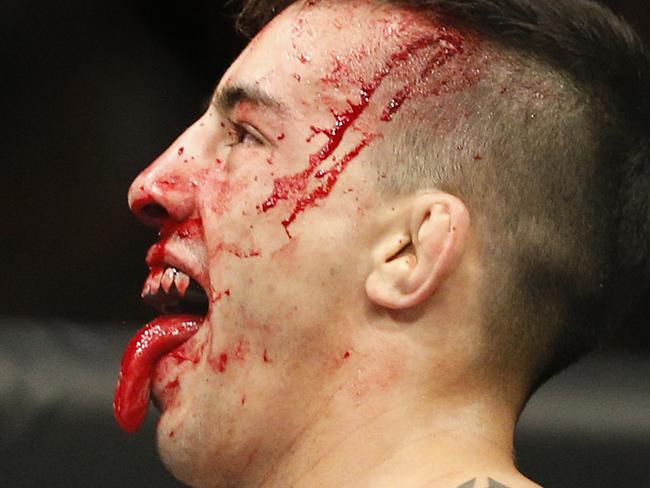 Thomas Almeida reacts between rounds in a bantamweight mixed martial arts bout against Brad Pickett at UFC 189 on Saturday, July 11, 2015, in Las Vegas. (AP Photo/John Locher)