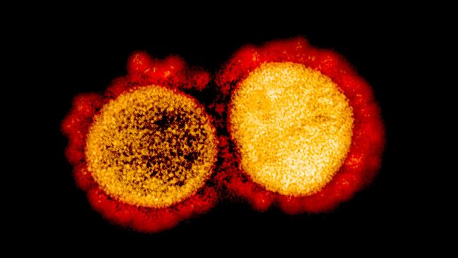This image shows a transmission electron micrograph of SARS-CoV-2 virus particles, isolated from a patient. Picture: AFP
