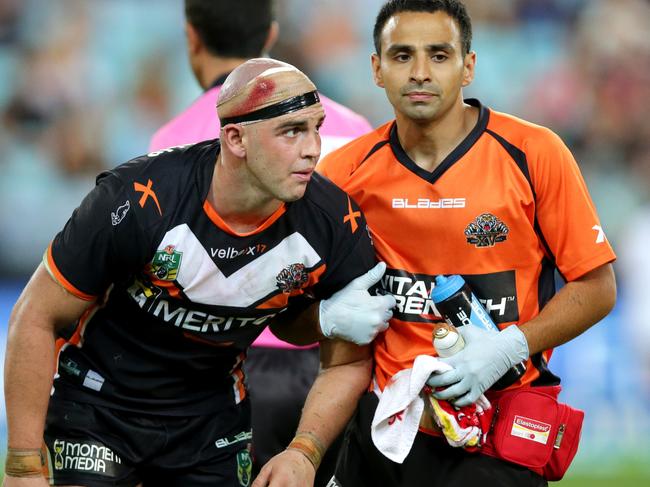 Former Wests Tigers forward Liam Fulton understands Boyd Cordner’s struggles because of multiple concussions. Picture: Gregg Porteous