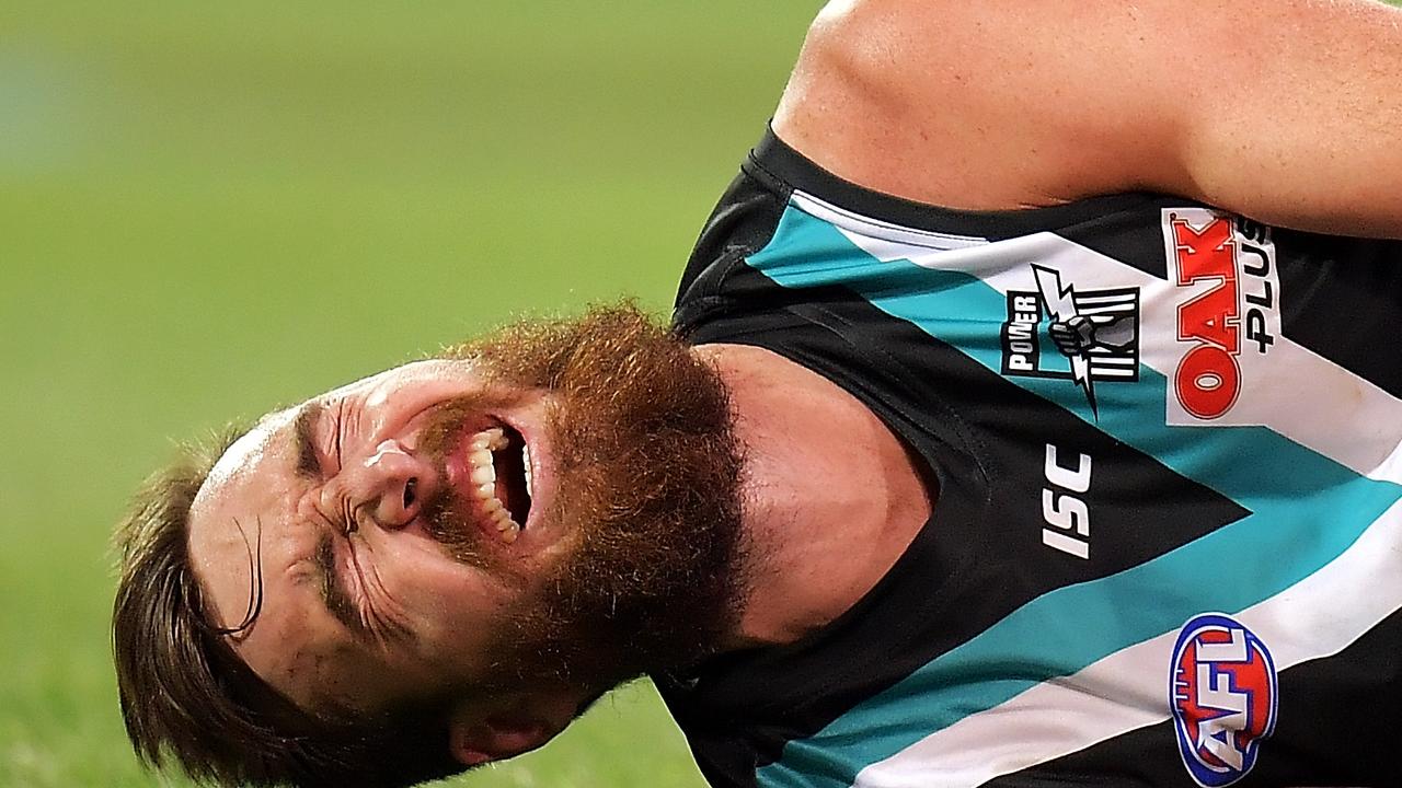 Charlie Dixon grimaces in pain after breaking his leg against West Coast. Picture: Daniel Kalisz/Getty Images)