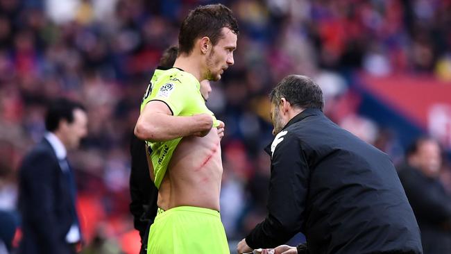 Angers' French defender Romain Thomas is helped by medical staff