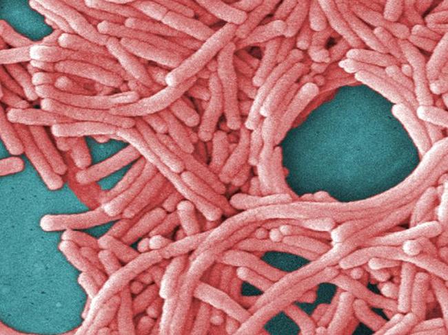 This 2009 colorized 8000X electron micrograph image provided by the Centers for Disease Control and Prevention shows a large grouping of Gram-negative Legionella pneumophila bacteria. Cases of Legionnaire’s disease have tripled in the last decade, U.S. health officials said Thursday, Aug. 18, 2011, but the risk of dying from it is lower because of more effective treatment. (AP Photo/Janice Haney Carr)