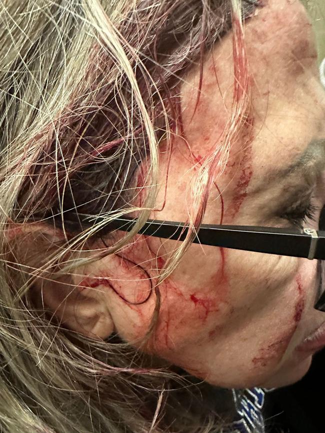 Caitlin Morrison, 45, was assaulted on a Melbourne tram on April 22. Picture: Supplied