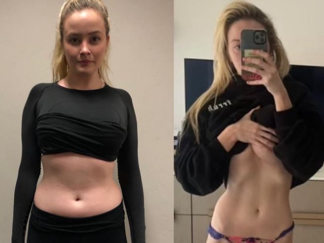 Simone Holtznagel has defended posting pictures showing her weight loss. Picture: Instagram