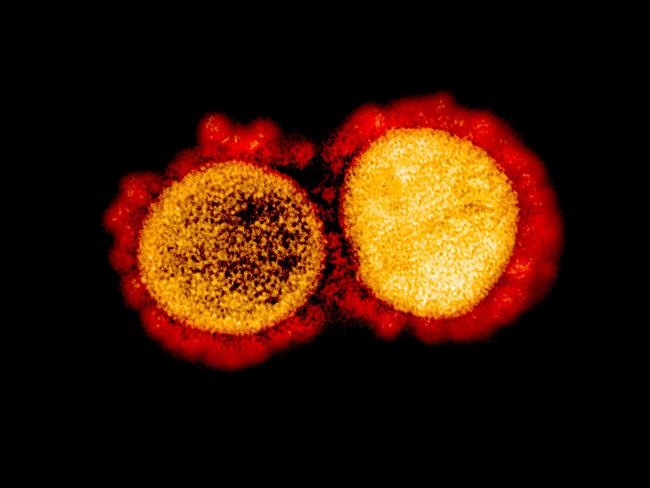 (FILES) This file undated handout image obtained August 11, 2020, courtesy of the National Institute of Allergy and Infectious Diseases(NIH/NIAID), shows a transmission electron micrograph of SARS-CoV-2 virus particles, isolated from a patient,captured and color-enhanced at the NIAID Integrated Research Facility (IRF) in Fort Detrick, Maryland. - US scientists are developing a strain of the coronavirus that could be used to deliberately infect volunteers in so-called "challenge studies," a government agency said August 14. The work is preliminary and the government is continuing to prioritize randomized clinical trials of vaccine candidates, the National Institute for Allergies and Infectious Diseases (NIAID) said. (Photo by Handout / National Institute of Allergy and Infectious Diseases / AFP) / RESTRICTED TO EDITORIAL USE - MANDATORY CREDIT "AFP PHOTO /NATIONAL INSTITUTE OF ALLERGY AND INFECTIOUS DISEASES/HANDOUT " - NO MARKETING - NO ADVERTISING CAMPAIGNS - DISTRIBUTED AS A SERVICE TO CLIENTS