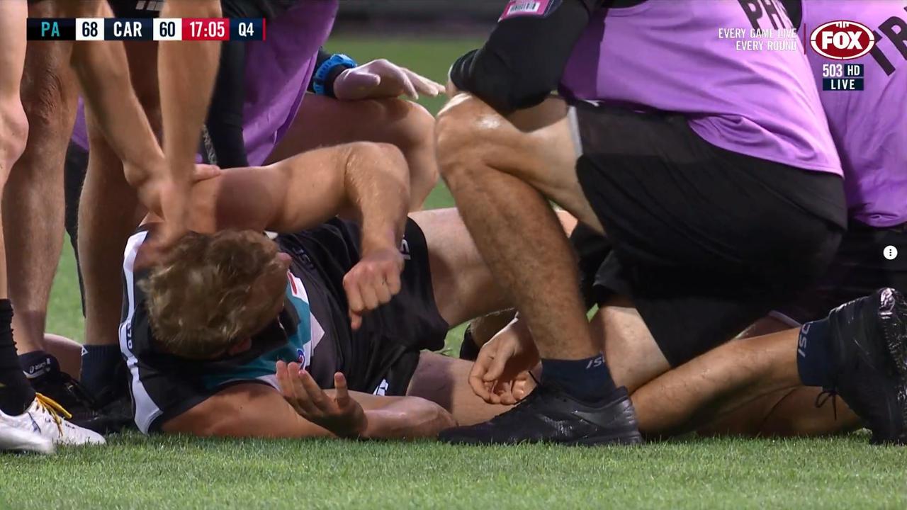 Port Adelaide's Jack Watts has suffered a nasty leg injury against Carlton.